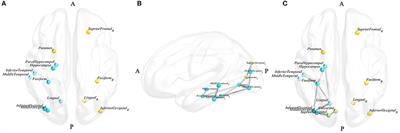 Structural Brain Network Alteration and its Correlation With Structural Impairments in Patients With Depression in de novo and Drug-Naïve Parkinson's Disease